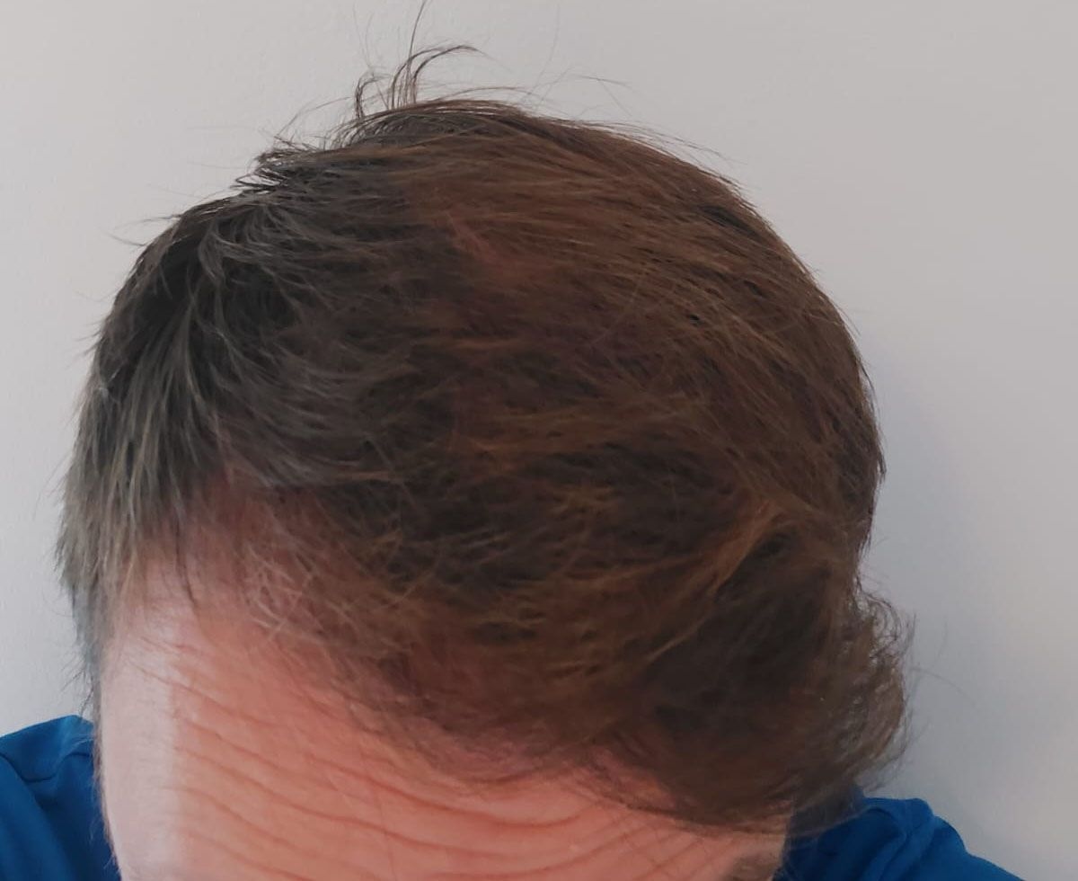 Adam After.jpg