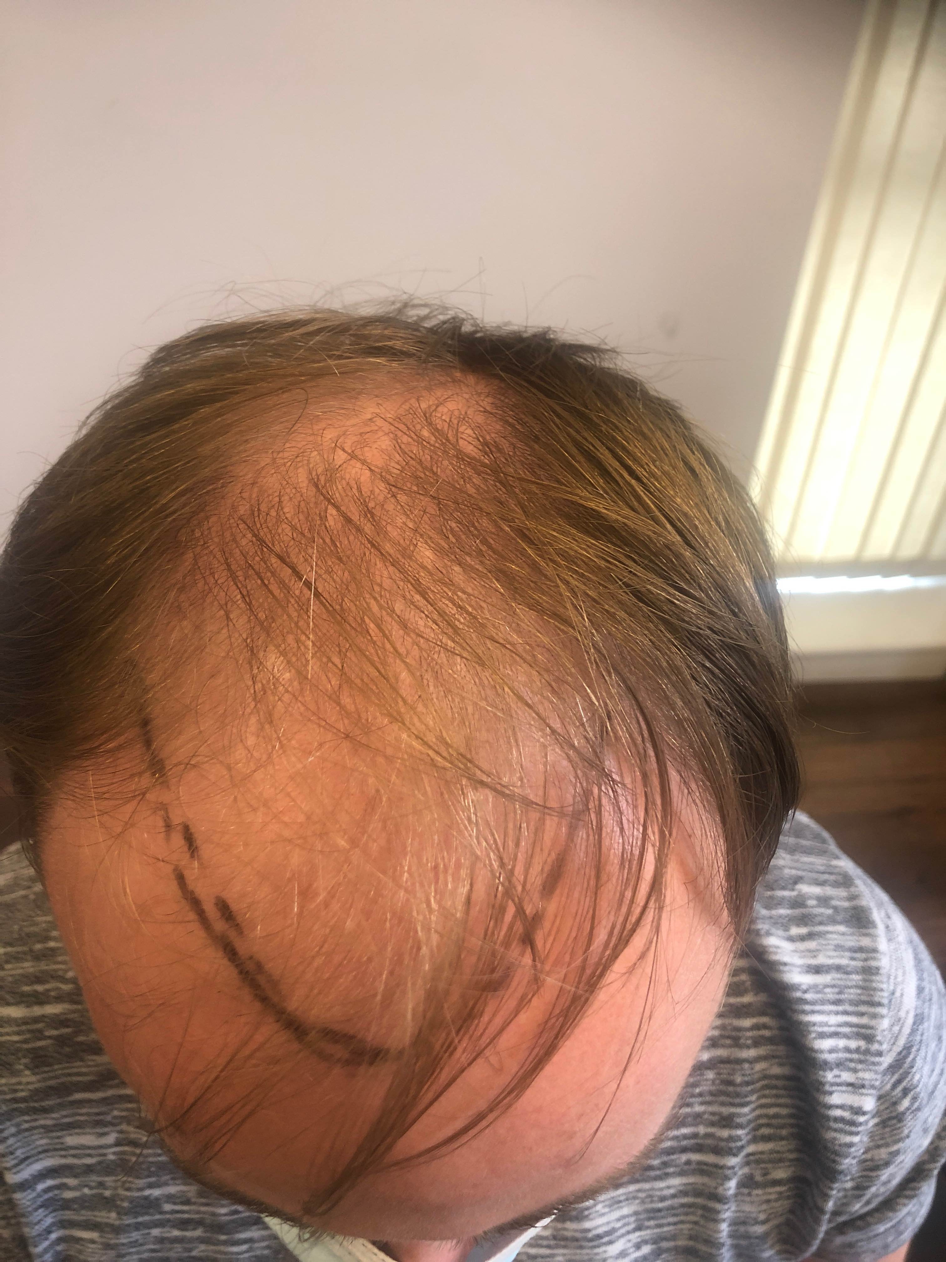 Adam before.jpg