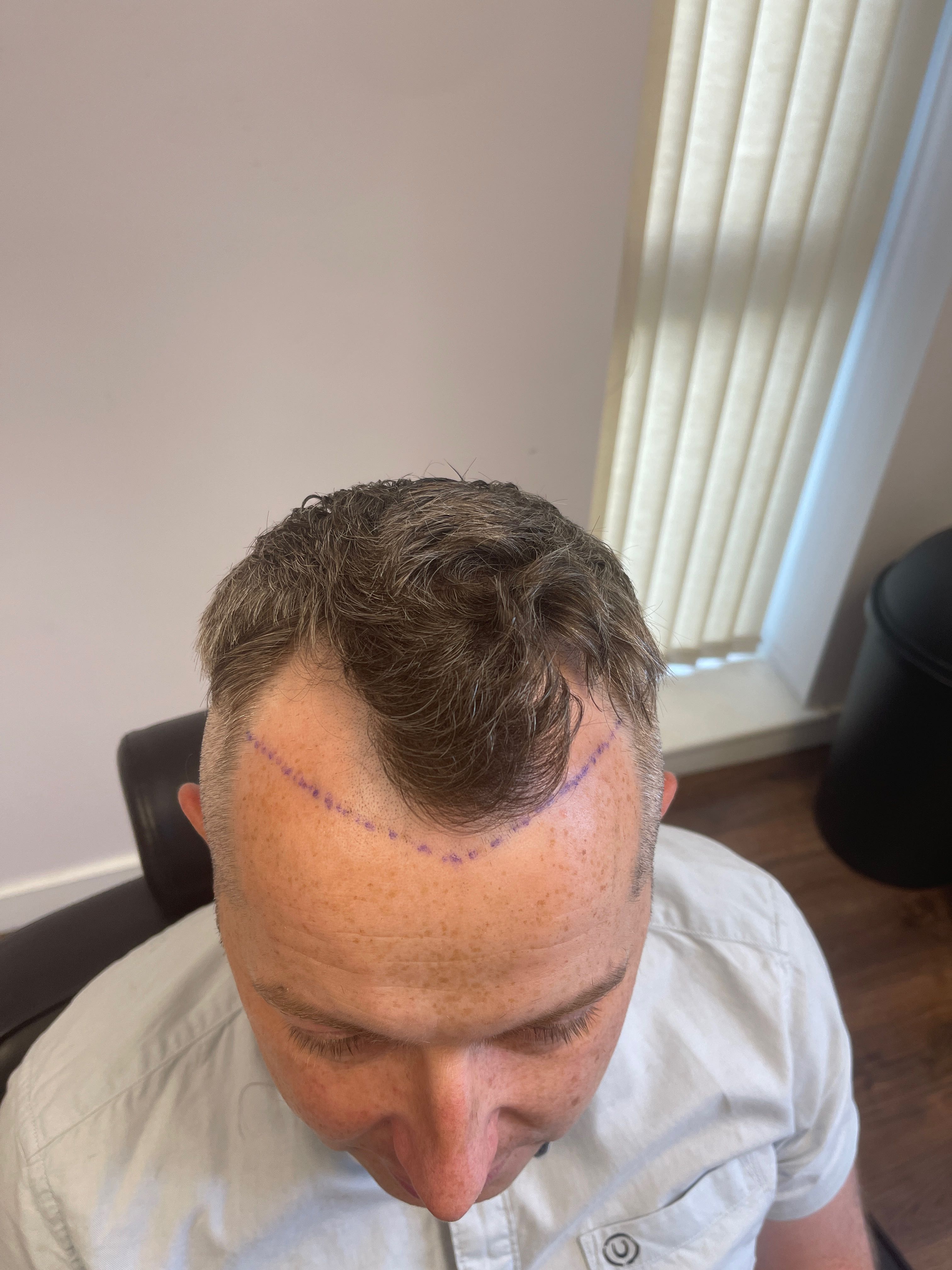 Patrick O'Connor before.jpg