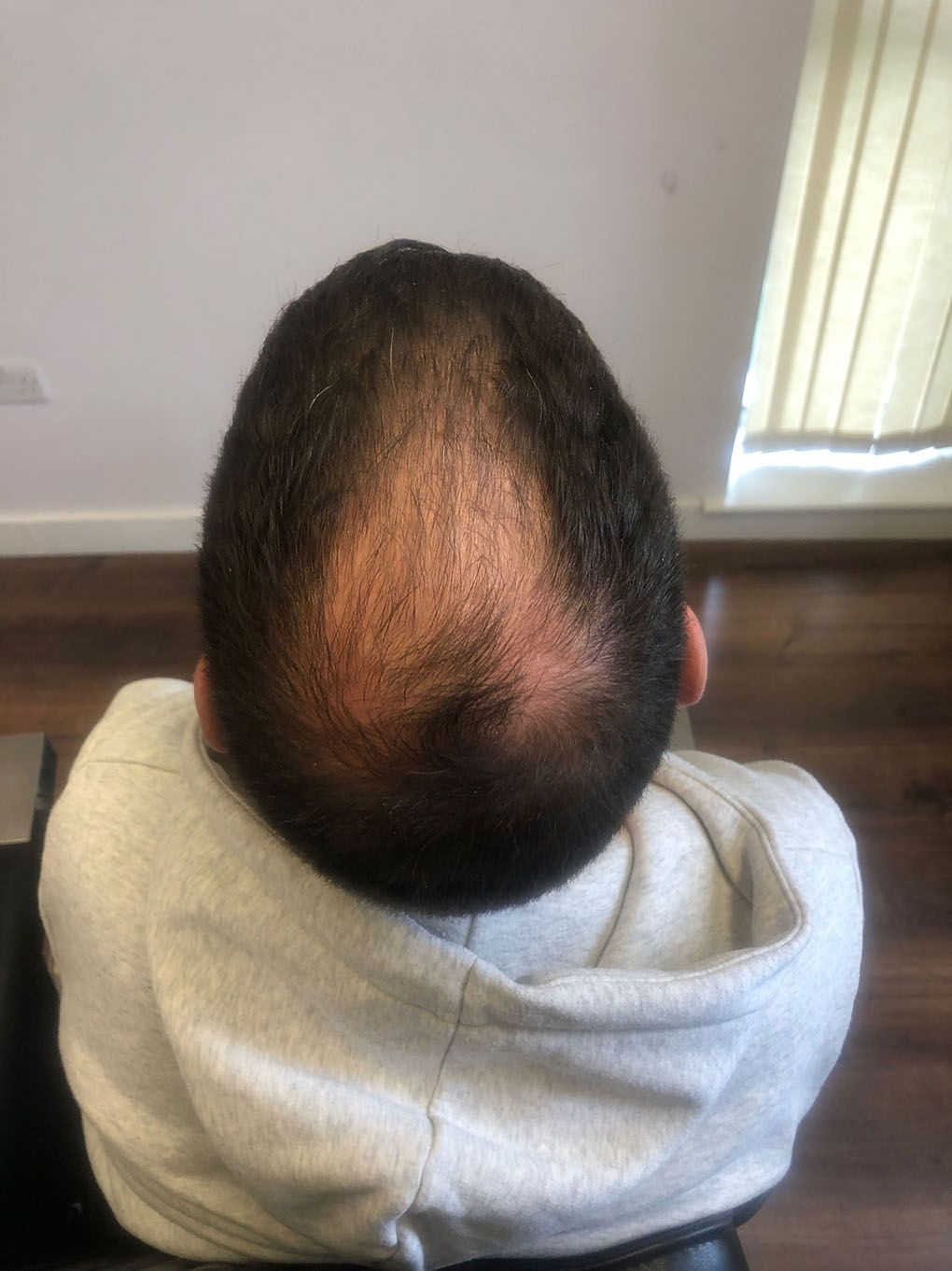 Tommy Durkin Before.jpg