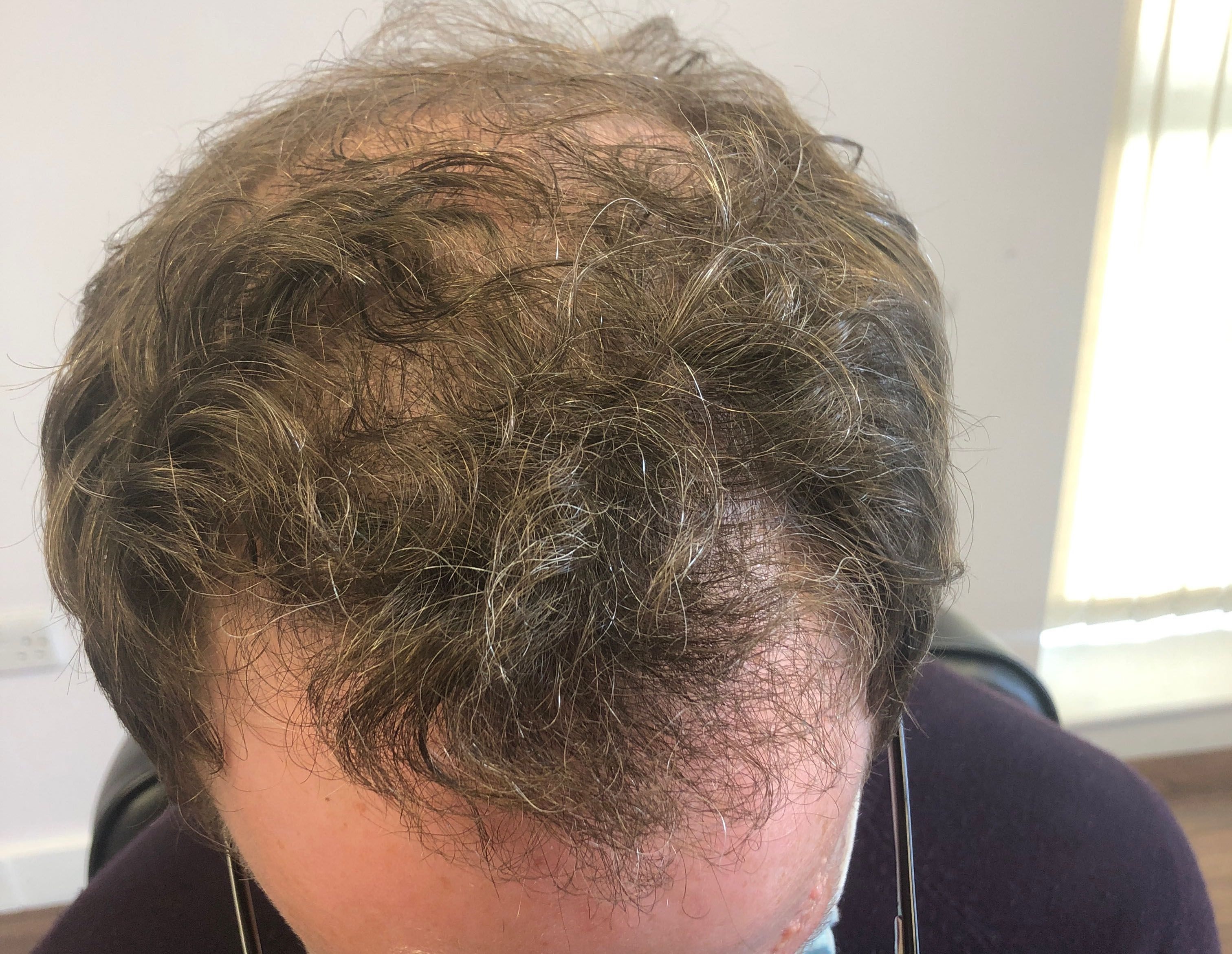 gerard noonan after.jpg