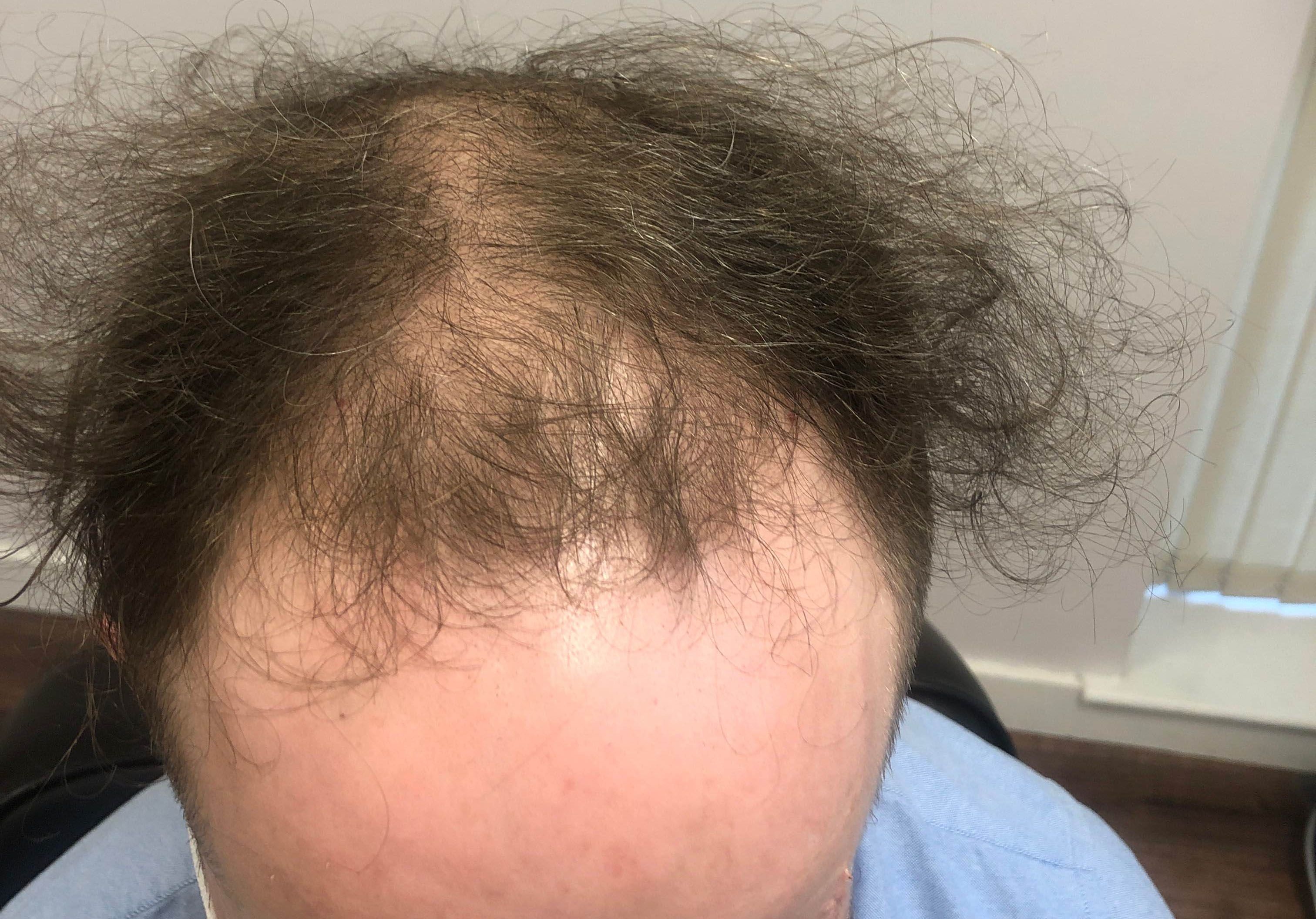 gerard noonan before.jpg