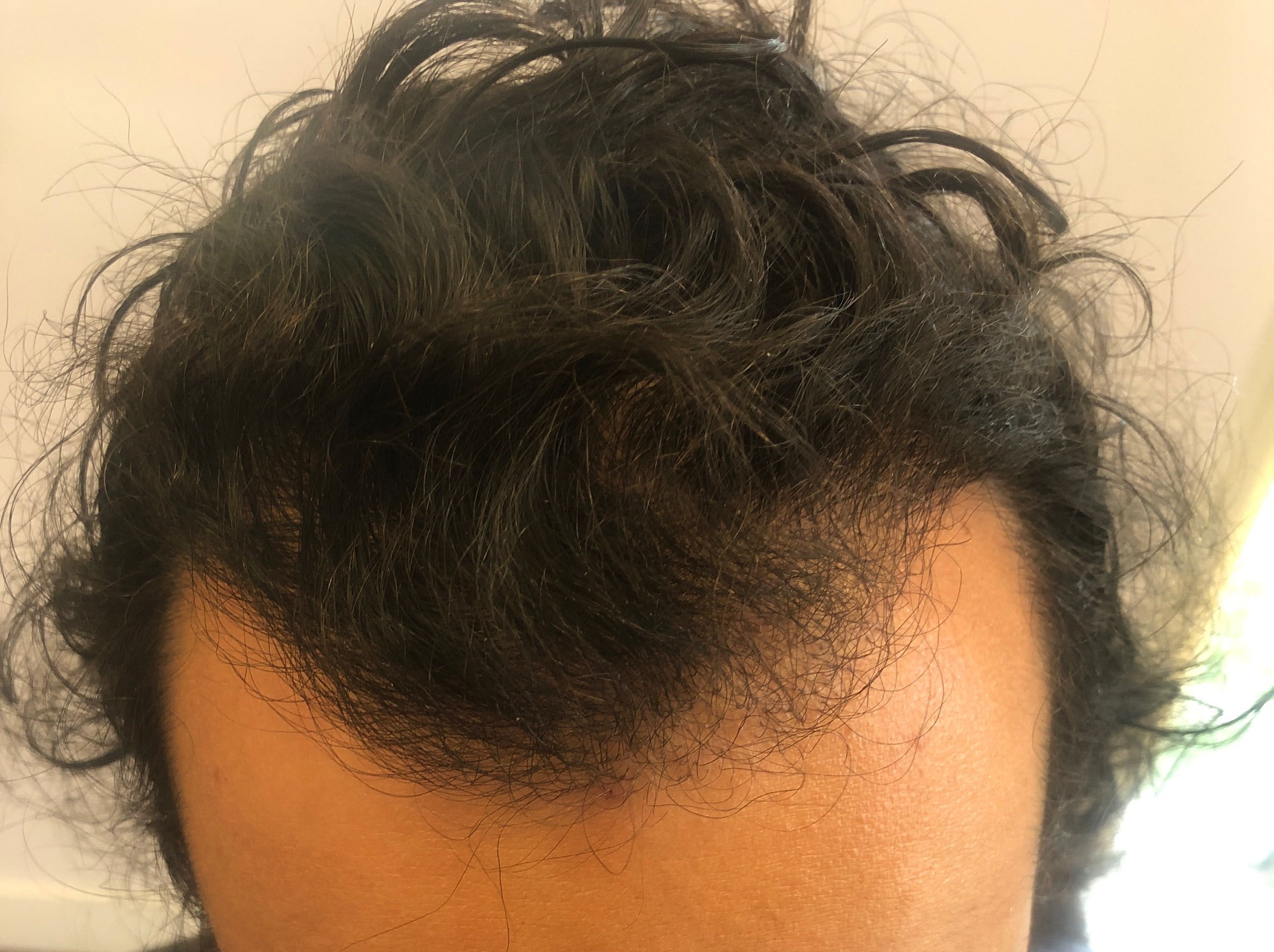 julio rocca 6 mt after.jpg