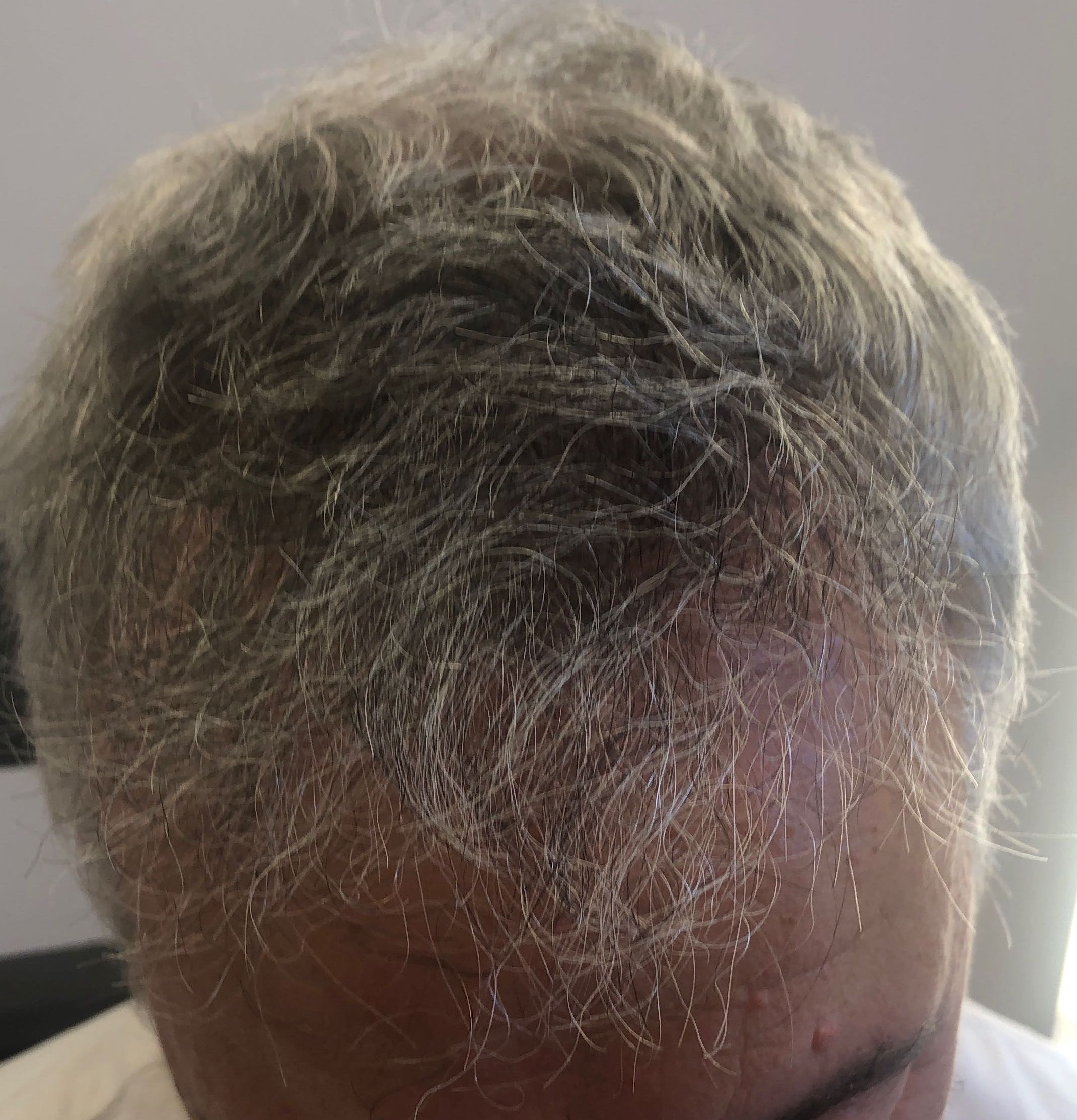 pat delaney after.jpg